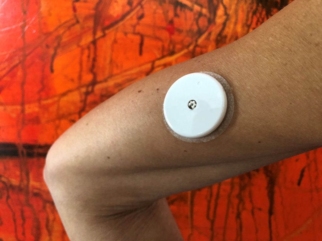 A glucose sensor attached to the arm